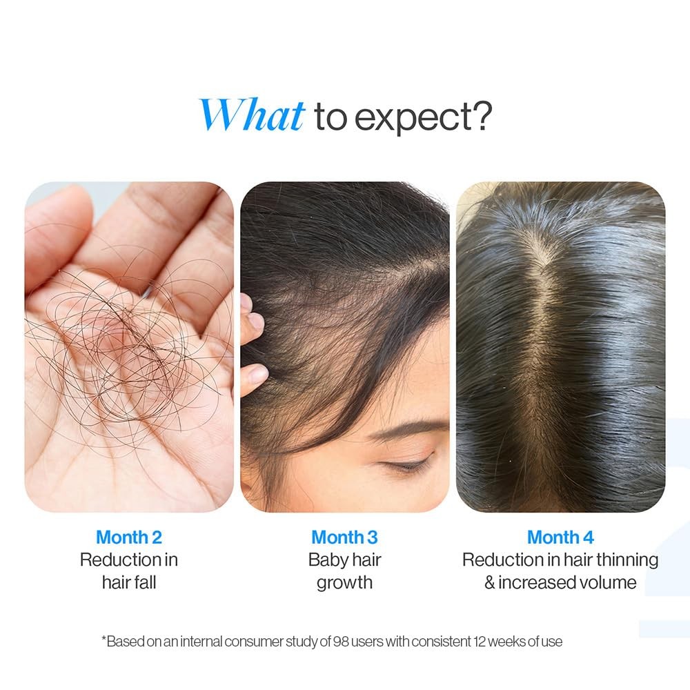 Be Bodywise Rosemary Hair Growth Serum (Roll On)|3% Redensyl& 2% Anagain