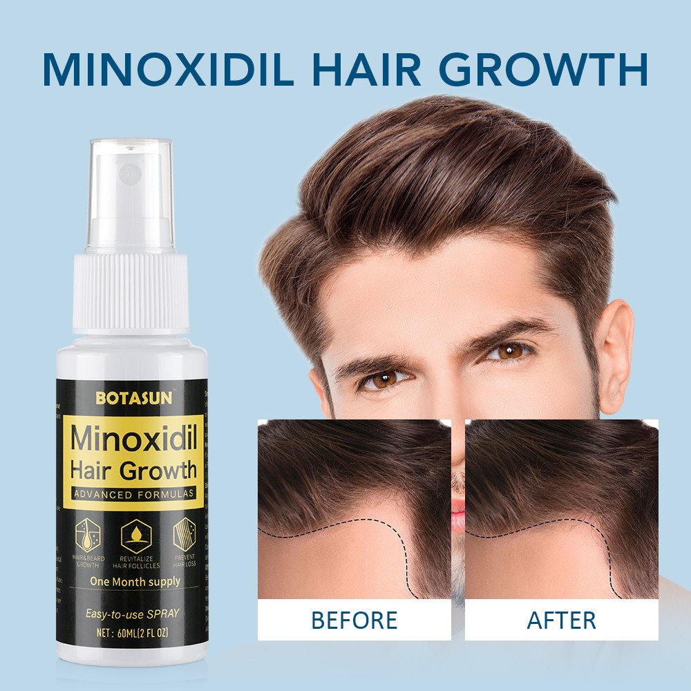 3 Pack 5% Minoxidil Hair Growth Serum Spray for Men Hair Regrowth 3 Month Supply