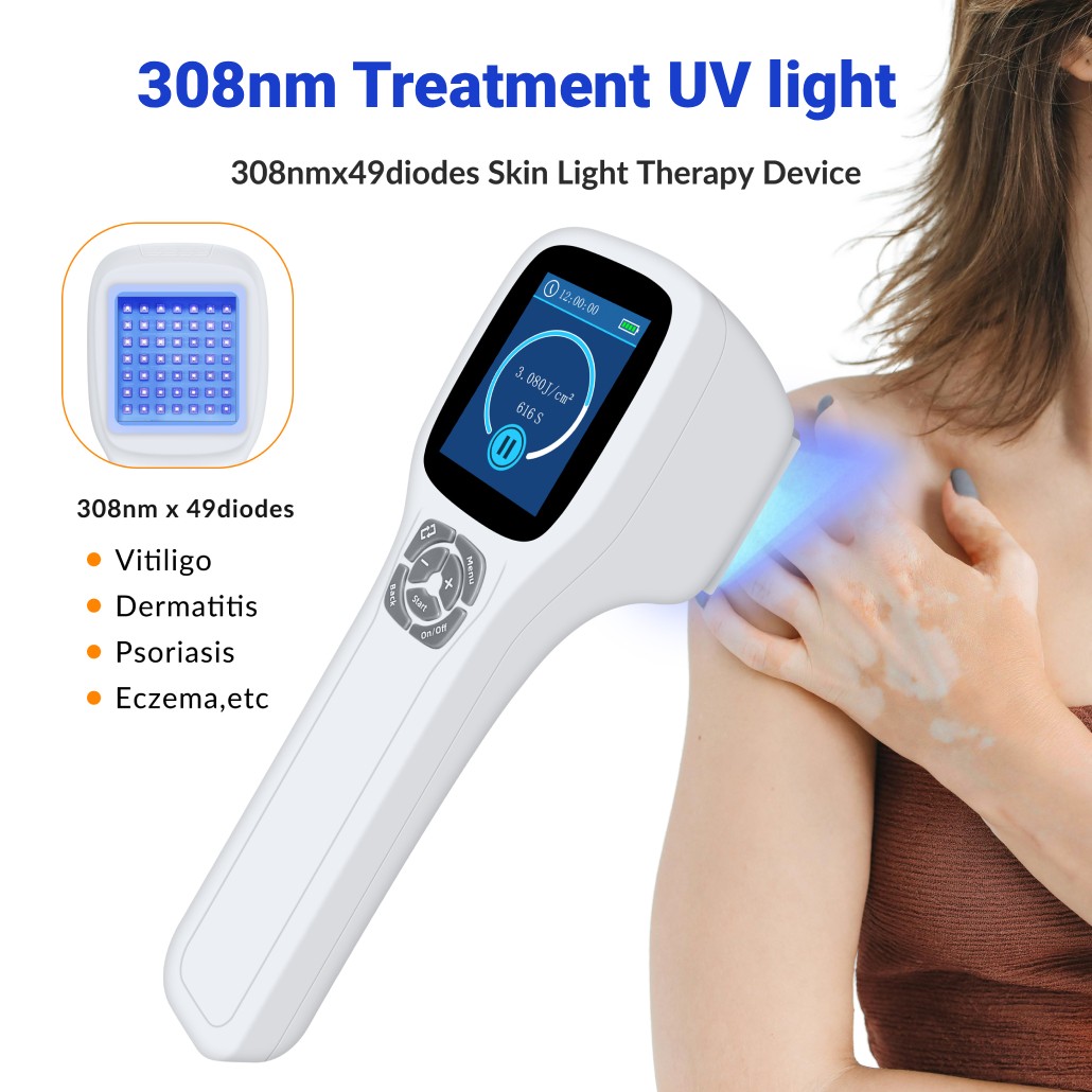 Handheld 308nm UVB Light Phototherapy Device Portable for Eczema Skin Therapy