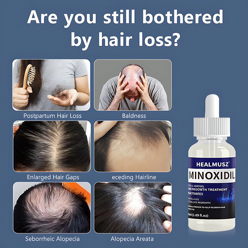 Minoxidil 5% Extra Strength for Men&Women Hair Regrowth Solution 6 Month Supply