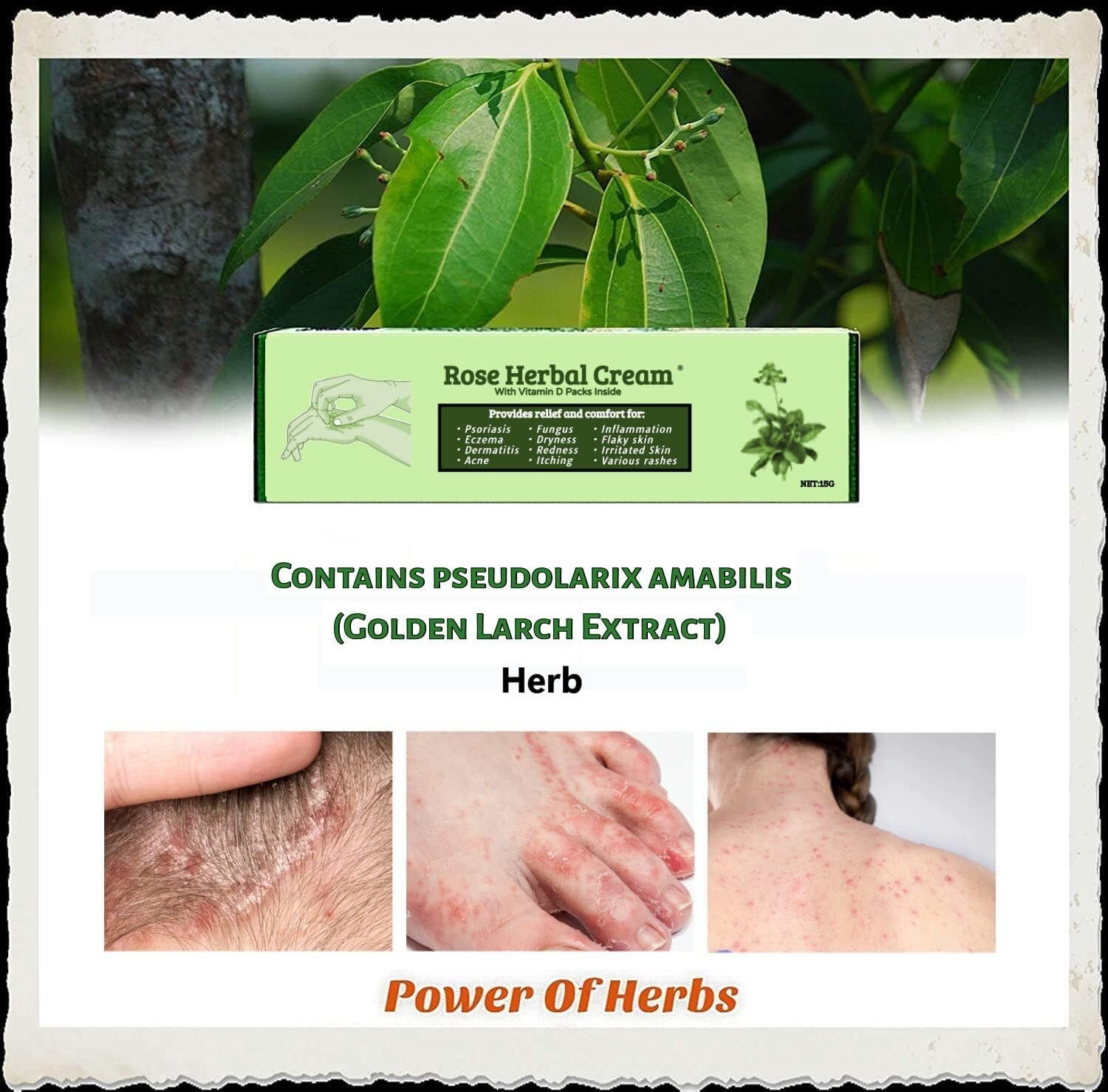 Eczema Psoriasis CREAM Ointment Inflammation Natural Anti Itching Dermatitis