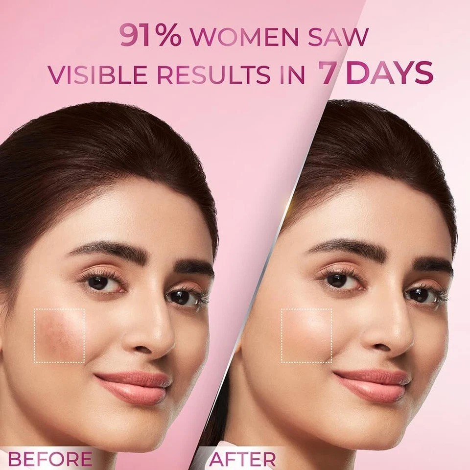 Pond’s Bright Beauty Anti-Pigmentation Serum 28 ml with 12% Gluta-Niacinamide
