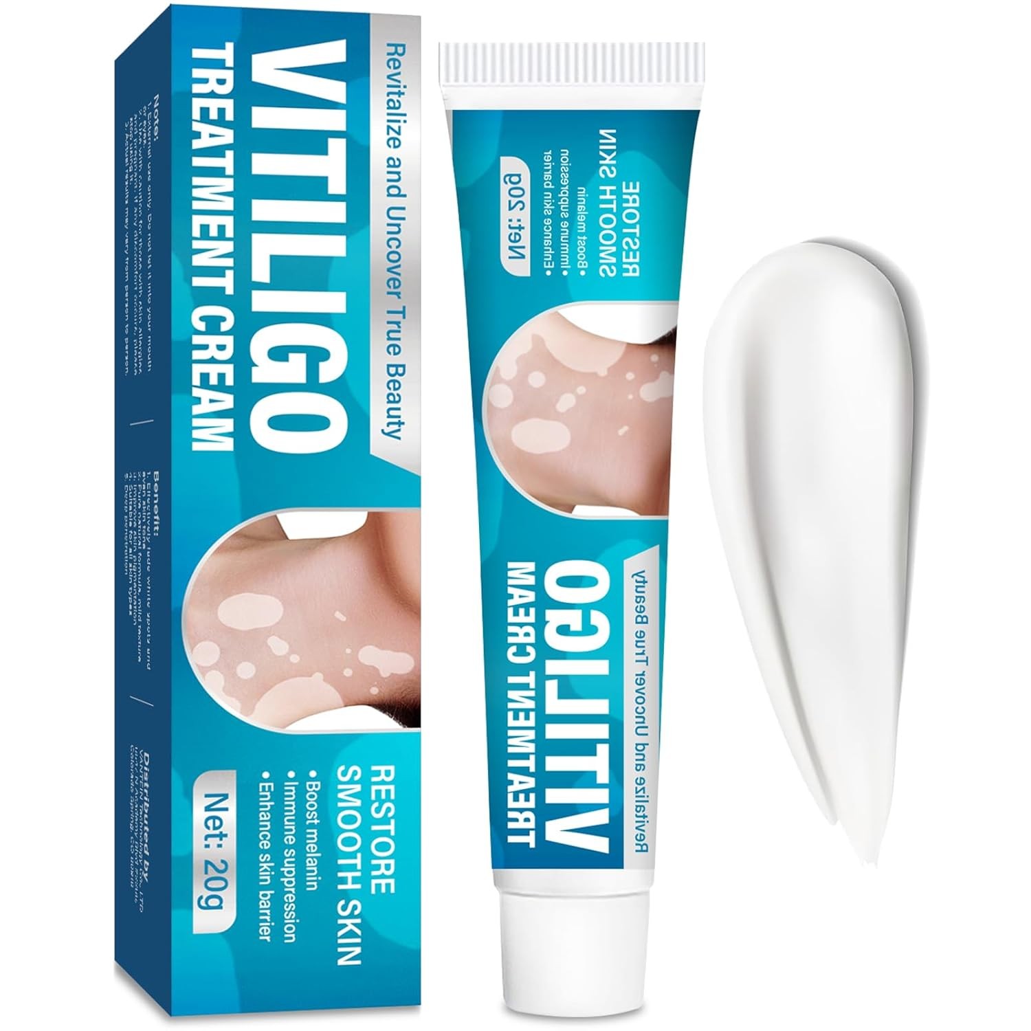 Natural Vitiligo Cream, Improves White Spots & Skin Pigmentation