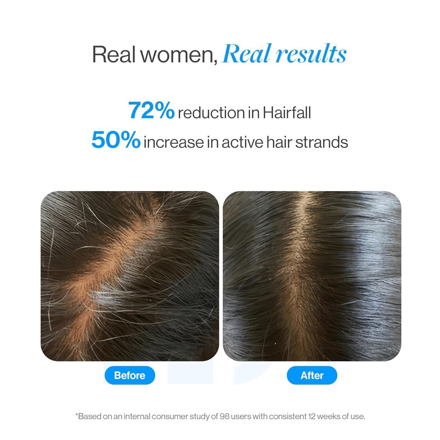 Be Bodywise Rosemary Hair Growth Serum (Roll On)|3% Redensyl& 2% Anagain