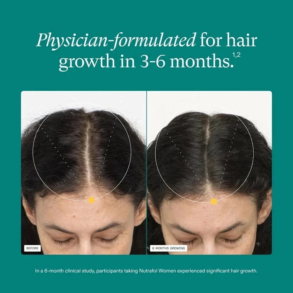 Pack of 3 Women’s Hair Growth Supplement 360 Caps Exp 07/2028, Fast Shipping