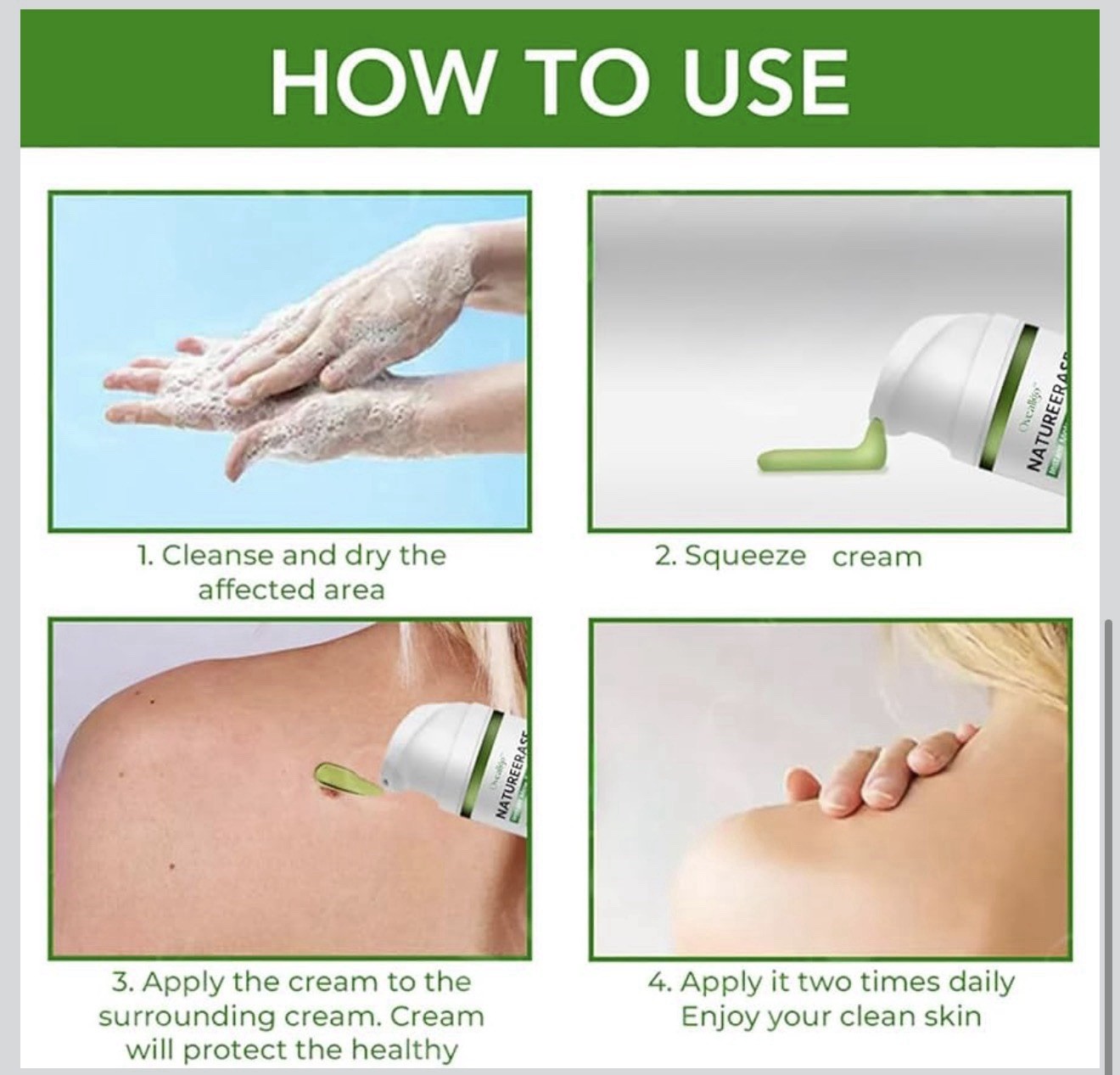 NatureErase Cream, Skin Repair, Natural Ingredients Suitable for All Skin Types