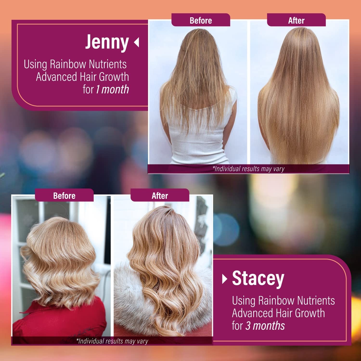 Hair Growth Vitamins for Women | Biotin 10000mcg Collagen Patented OptiMSM® g…
