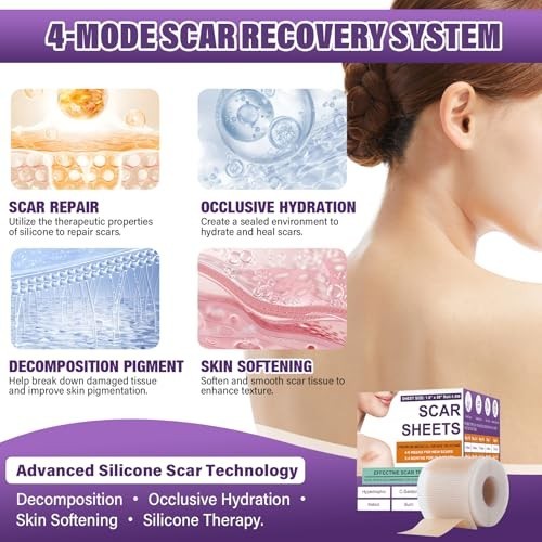 Silicone Scar Tape for Keloids Hypertrophic Scars 1.6in x 150in 3.8m Roll Kit