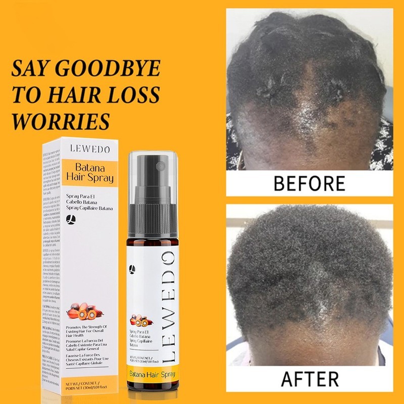 Natural Batana Oil Serum For Hair Growth Healthier Thicker Fuller Anti Hair Loss