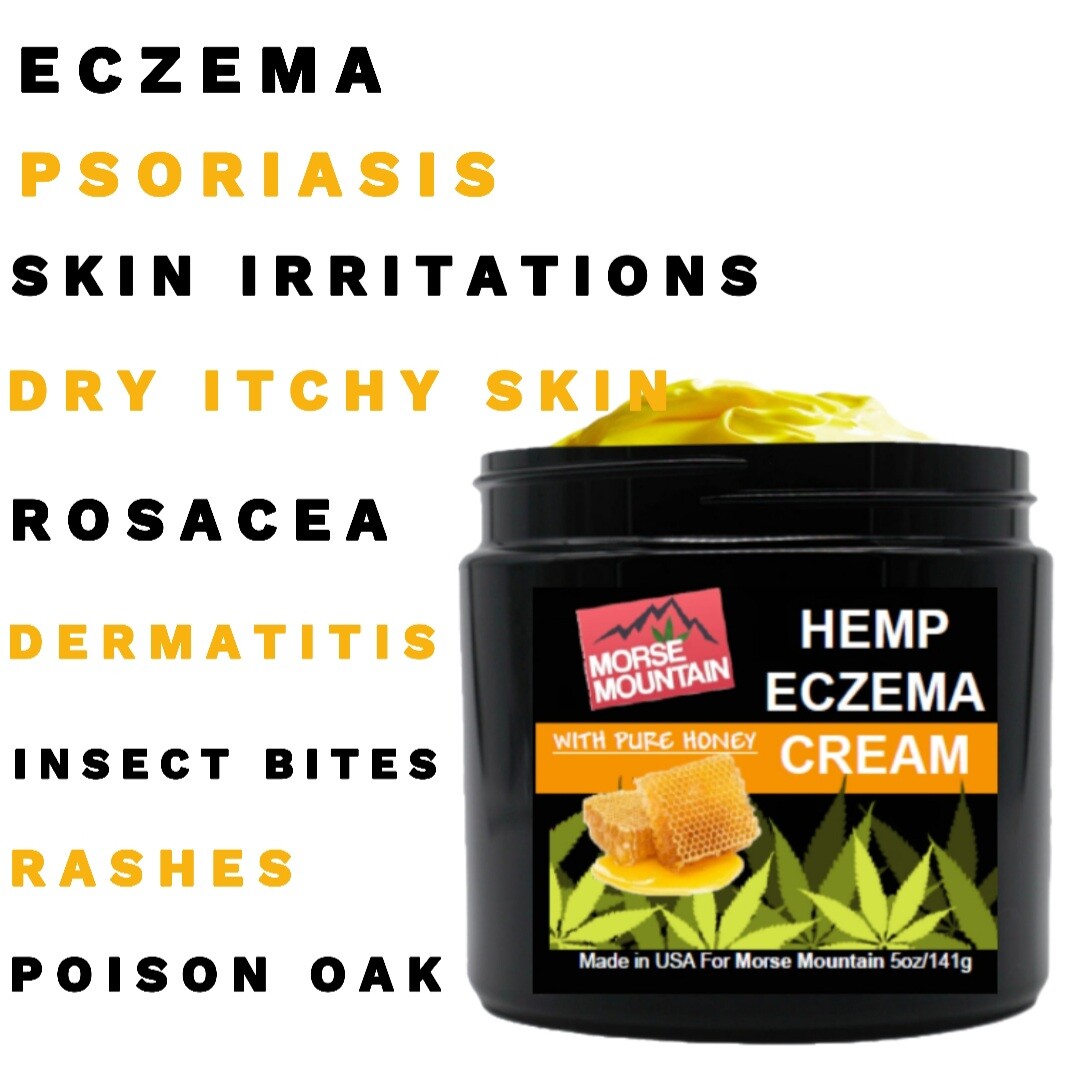 – PSORIASIS/ ECZEMA SOOTHING PURE HONEY CREAM Rosacea, Dermatitis and Shingles 