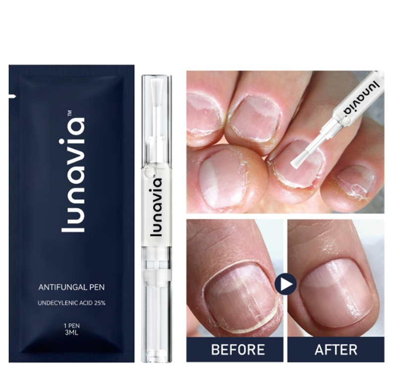6 Pack Lunavia Antifungal Pen, 25% Undecylenic Acid – Toenail Fungus Treatment