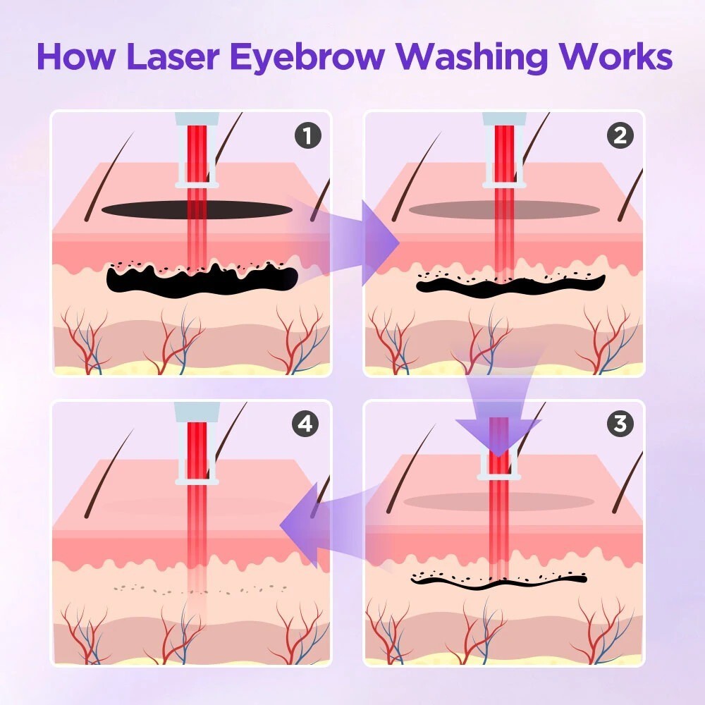 2IN1 808nm Diode Laser Hair Removal Pico NG YAG Laser Tattoo Beauty Machine