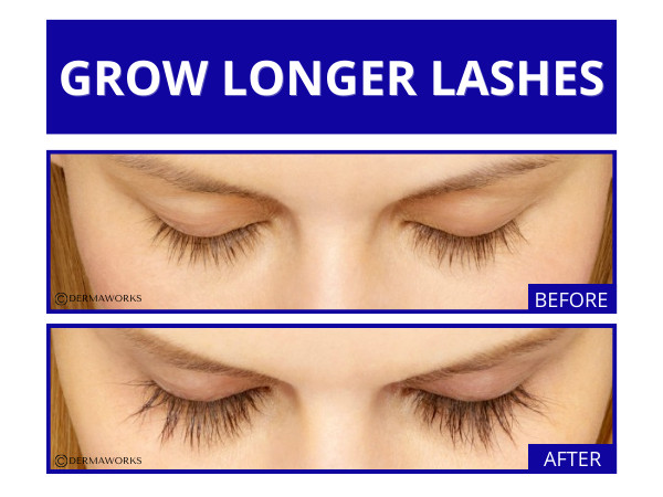 SPECTACULASH Eye lash Growth Serum. Grow Longer Lashes Naturally in JUST 60 DAYS