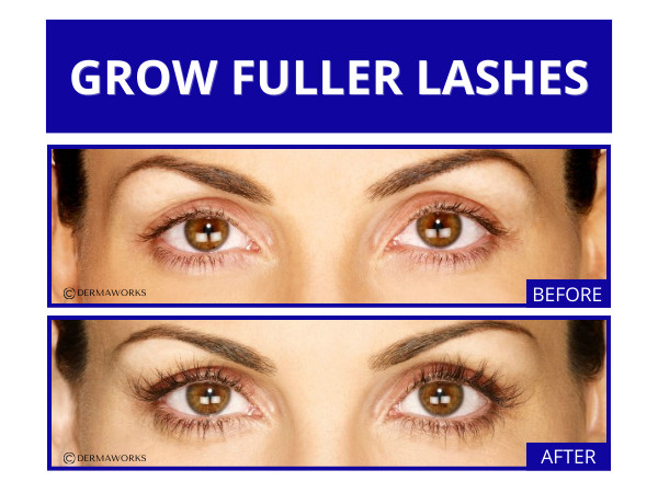 SPECTACULASH Eye lash Growth Serum. Grow Longer Lashes Naturally in JUST 60 DAYS