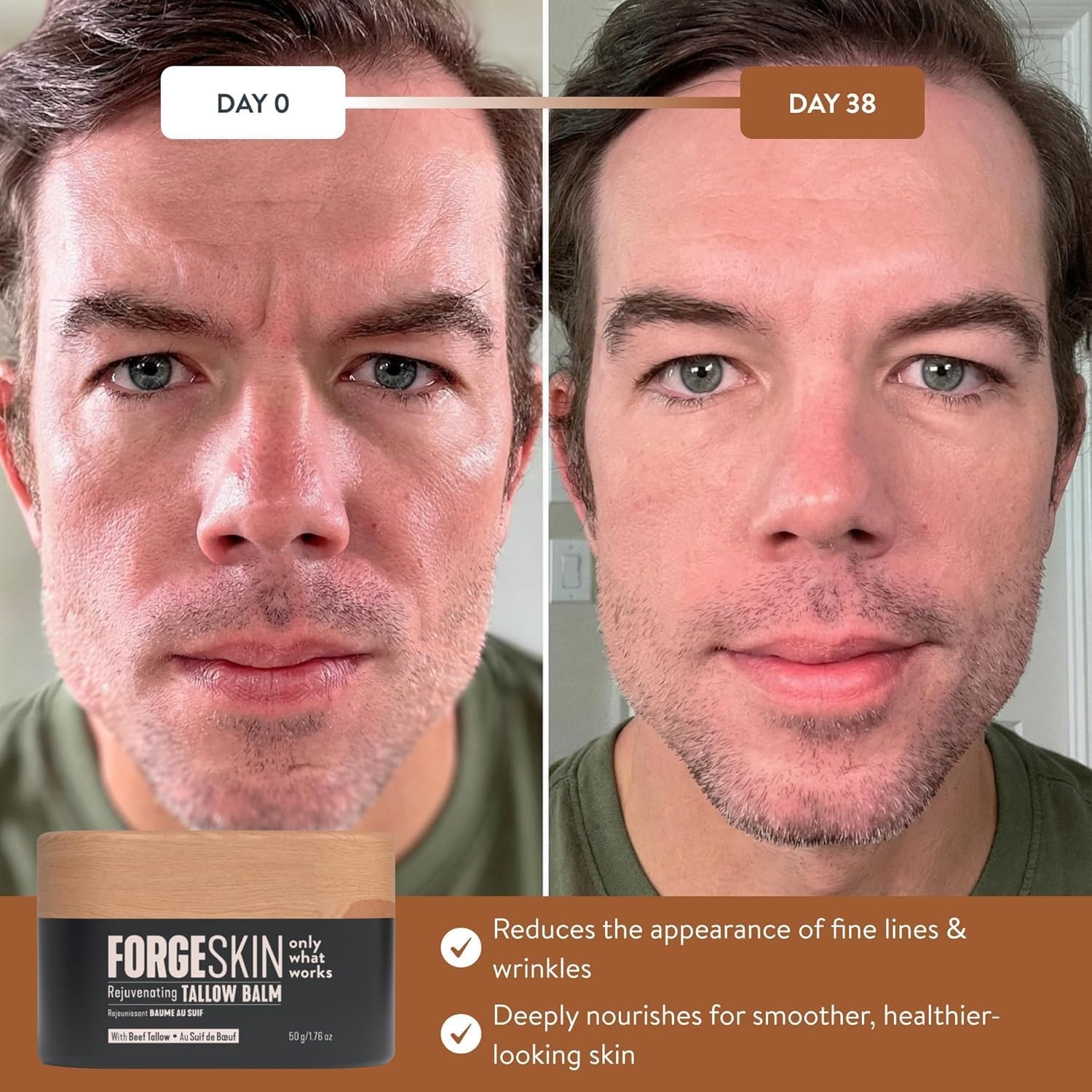 FORGE SKIN Men Face Tallow Balm 50g Beef Tallow Hydrating Cream (New Formula)