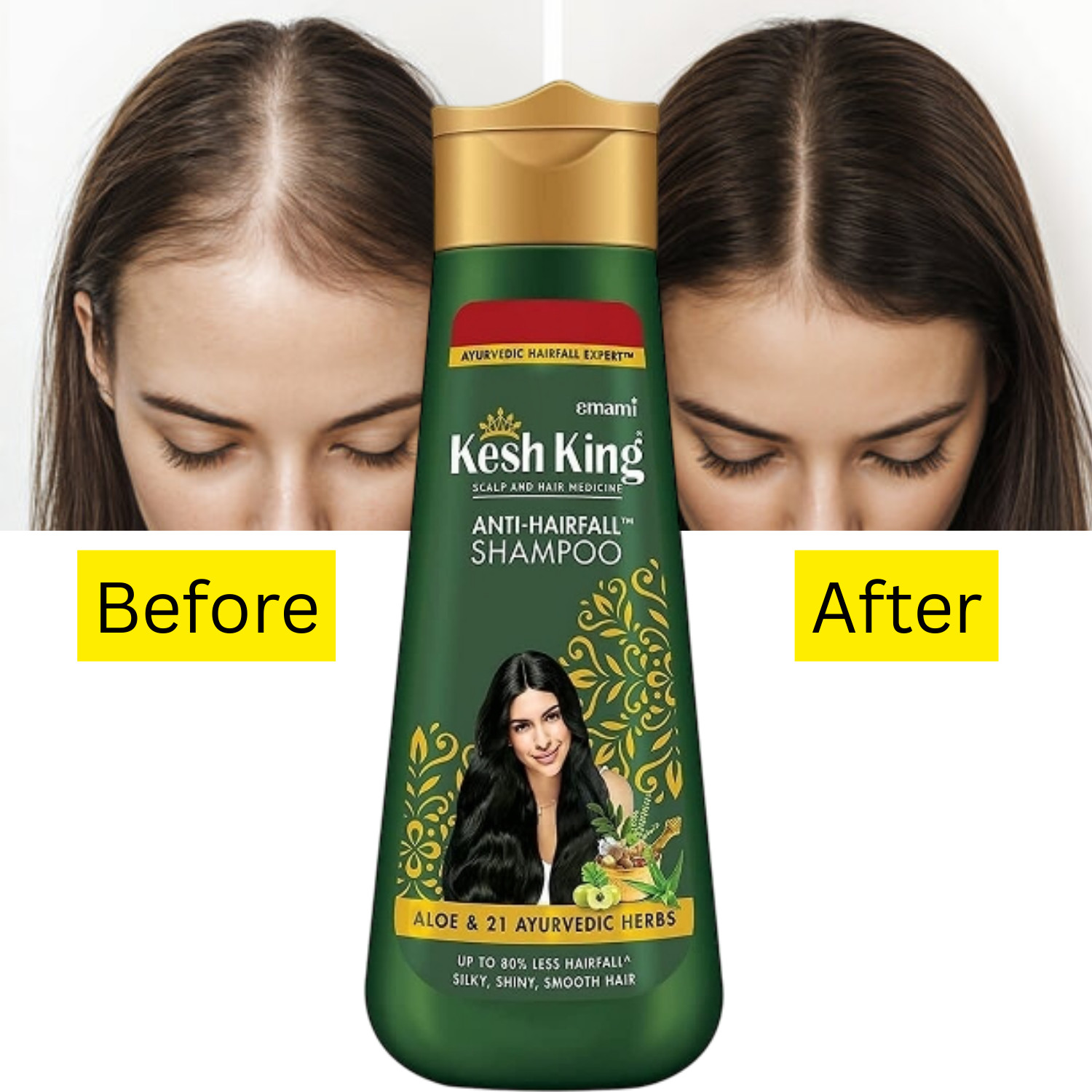 Kesh King Scalp Anti Hairfall Shampoo 21 Ayurvedic Herbs – 80 ml for hair growth