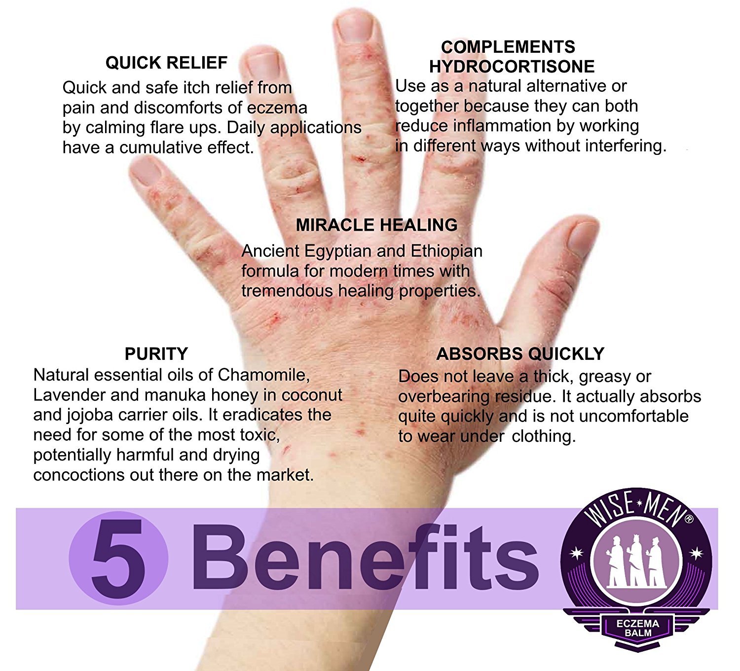 Eczema Relief Balm – Natural Skin Soothing Cream – An Essential Oil Remedy