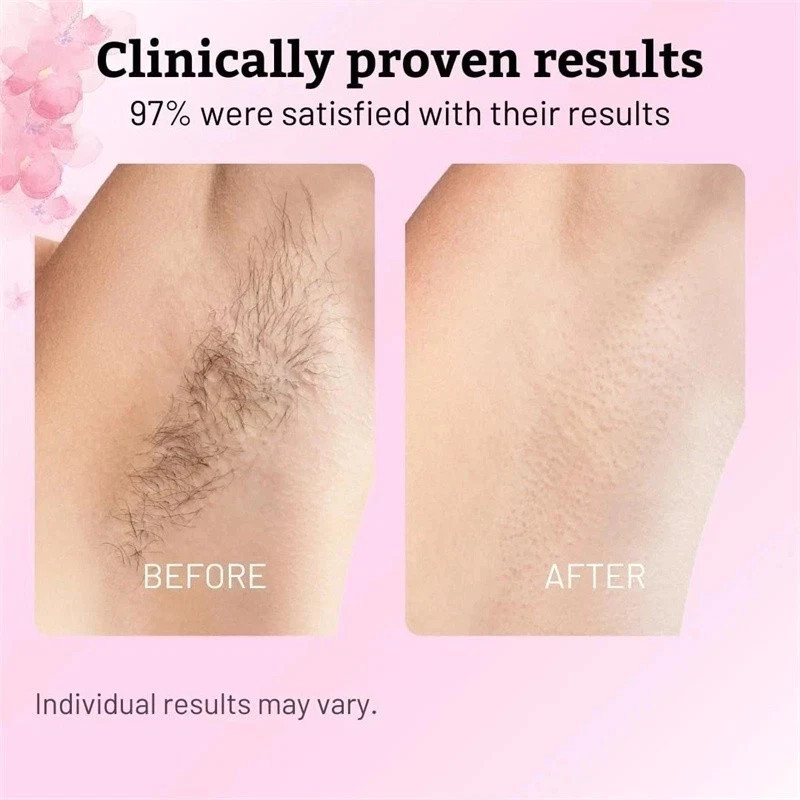 NEW Cyperus Rotundus Oil – 60ml Natural Cyperus Rotundus Oil For Hair Removal