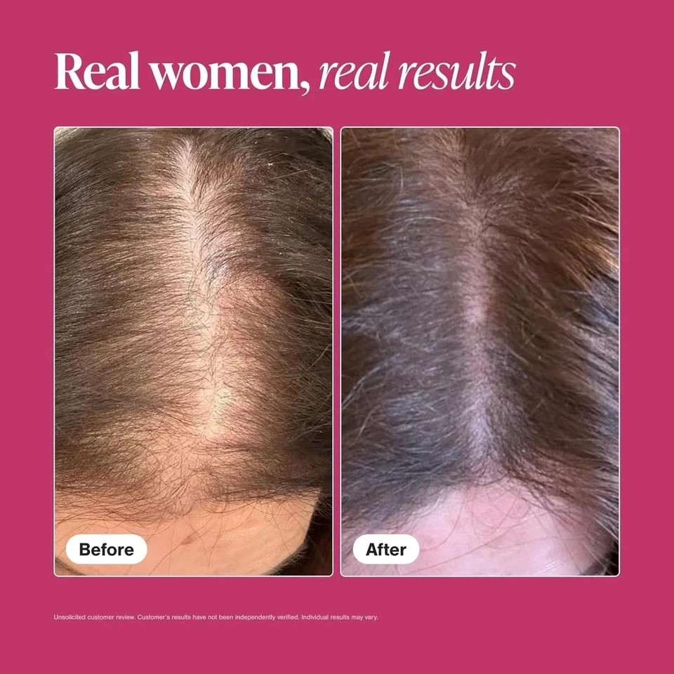Pack of 3 Viviscal Professional Hair Growth Supplement Women 180 Tablets- Sealed