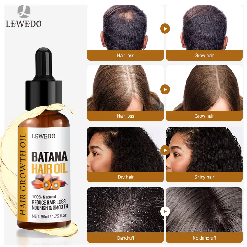 Lewedo Naturals Batana Oil Fast Hair Growth for Men Women Pure Batana Oil Nouris