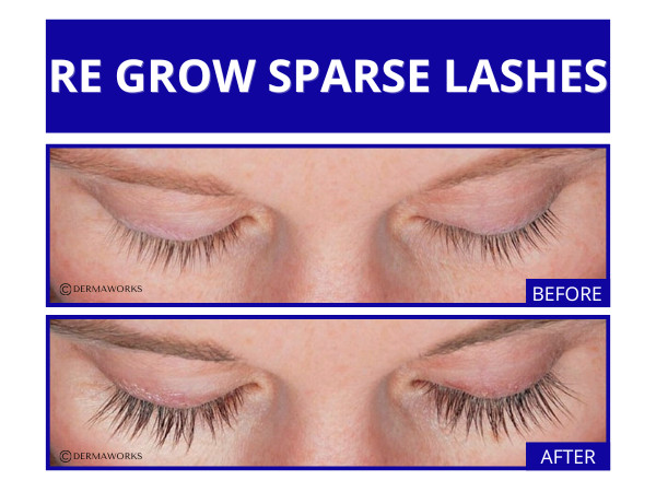SPECTACULASH Eye lash Growth Serum. Grow Longer Lashes Naturally in JUST 60 DAYS