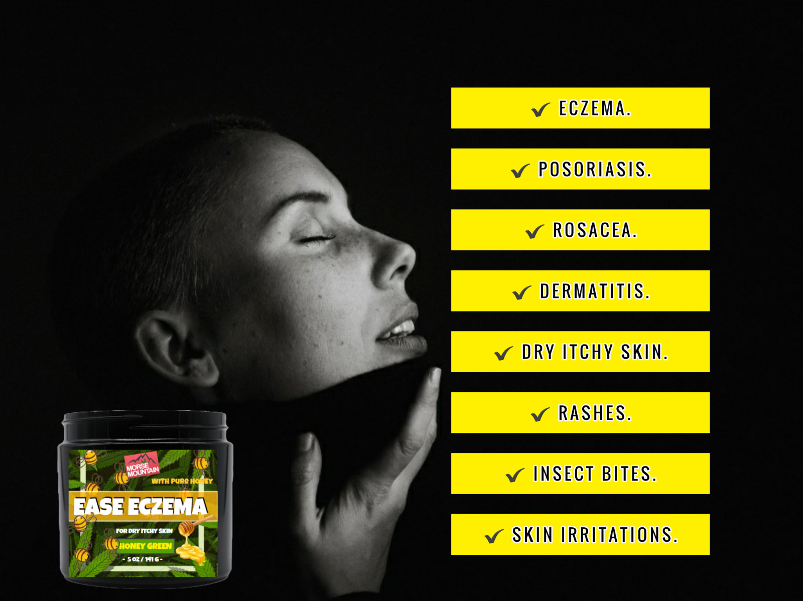 Eczema / Psoriasis Honey Ointment Cream Natural Dermatitis Treatment