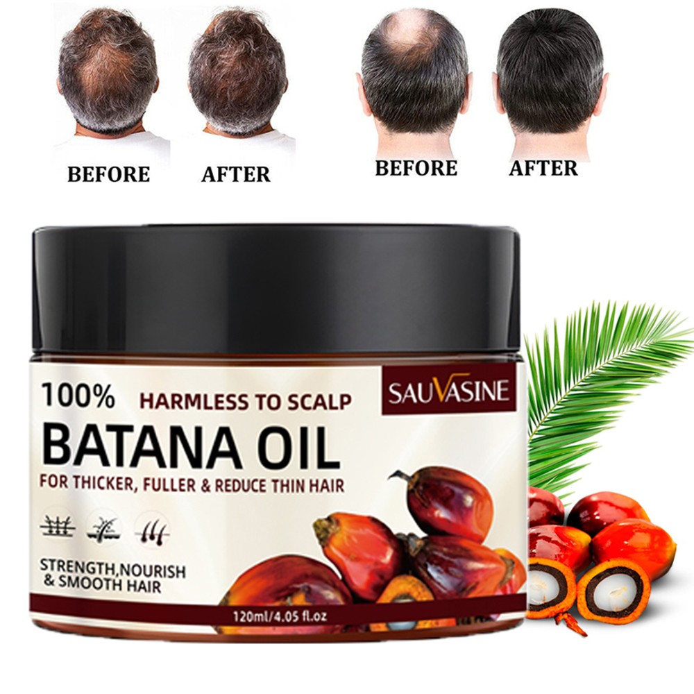 Natural Batana Oil Serum For Hair Growth Healthier Thicker Fuller Anti Hair Loss