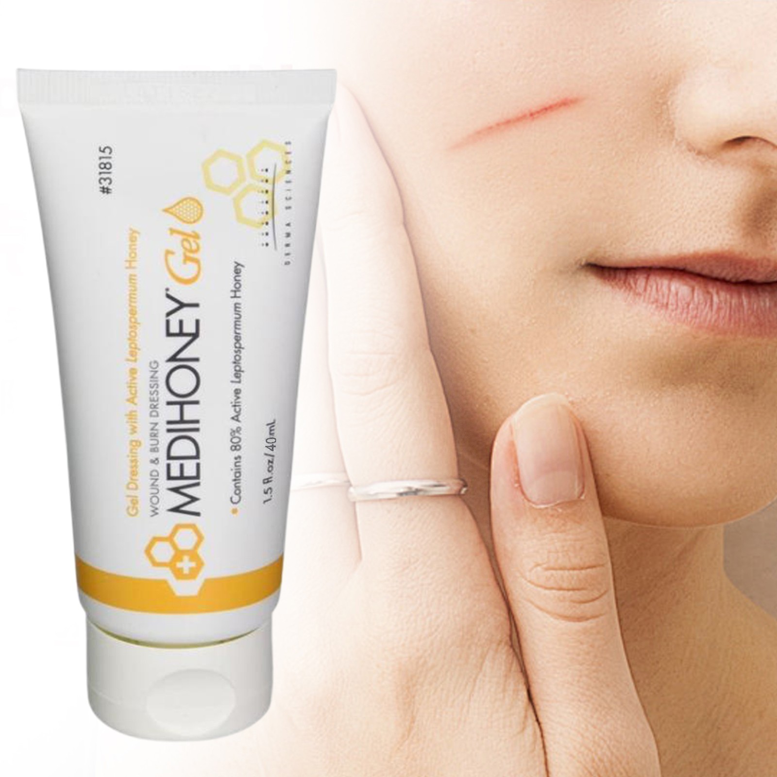 MediHoney – 1.5 oz Gel Wound & Burn Dressing Tube Medical Grade Honey NEW