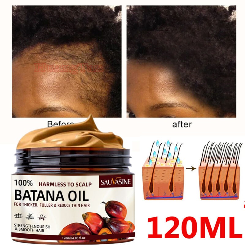 Natural Batana Oil Serum For Hair Growth Healthier Thicker Fuller Anti Hair Loss