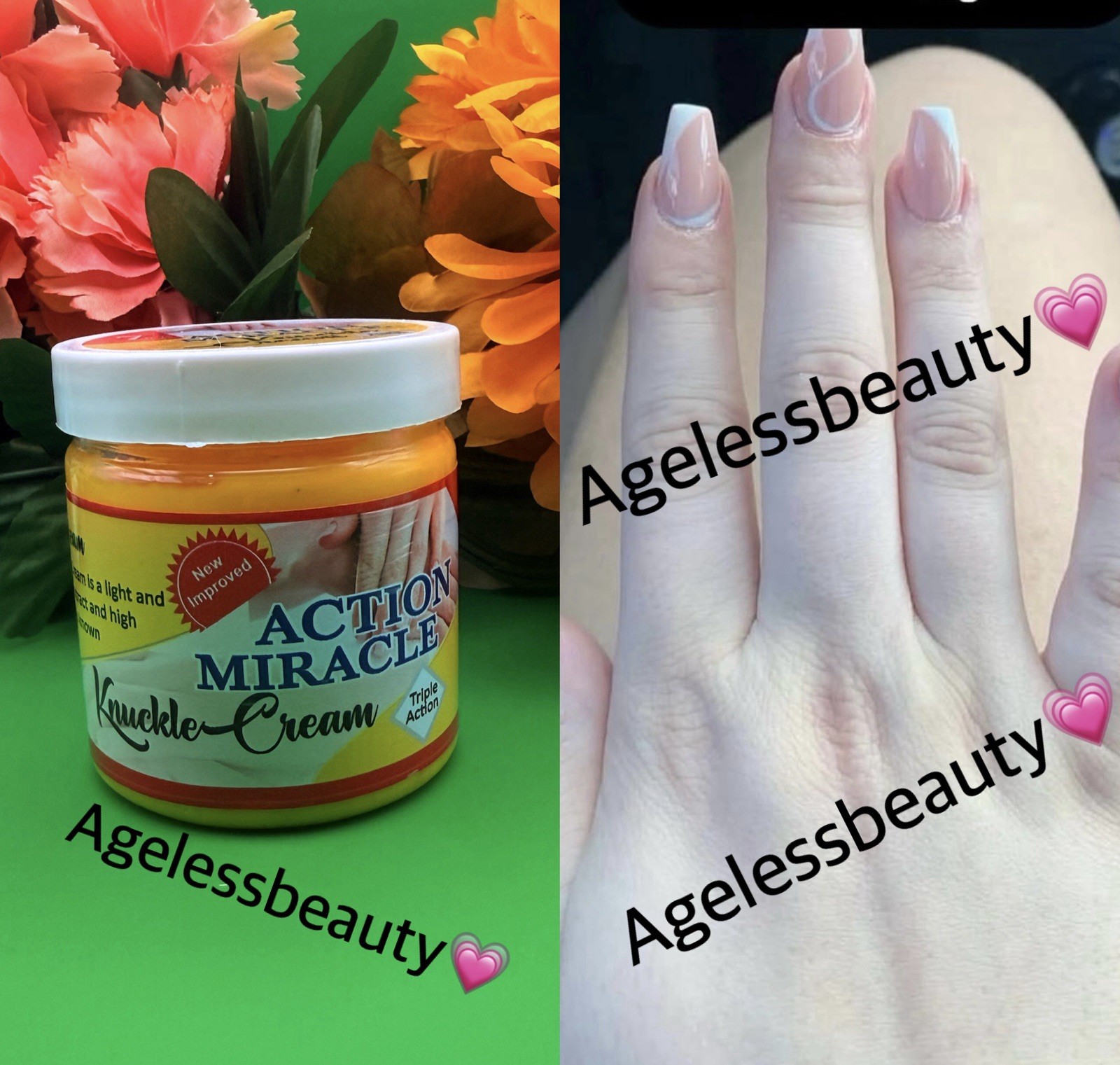 Action Miracle Knuckle Cream 3X Action 💯 Clean & Clear Knuckle Remedy Jar