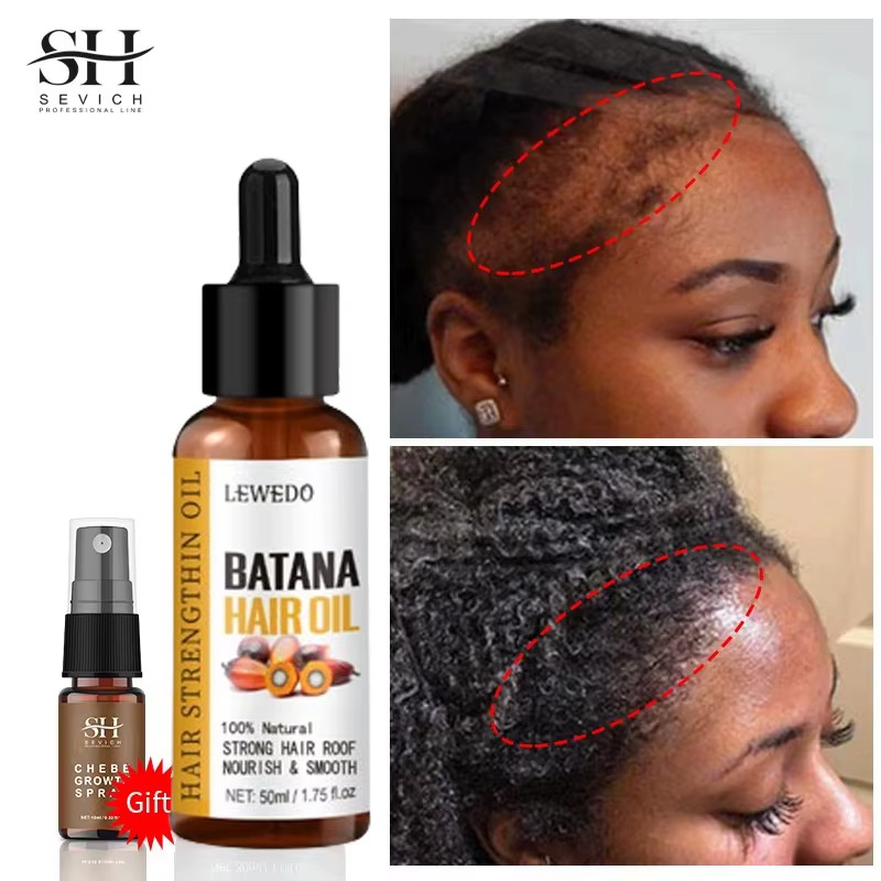 Lewedo Naturals Batana Oil Fast Hair Growth for Men Women Pure Batana Oil Nouris