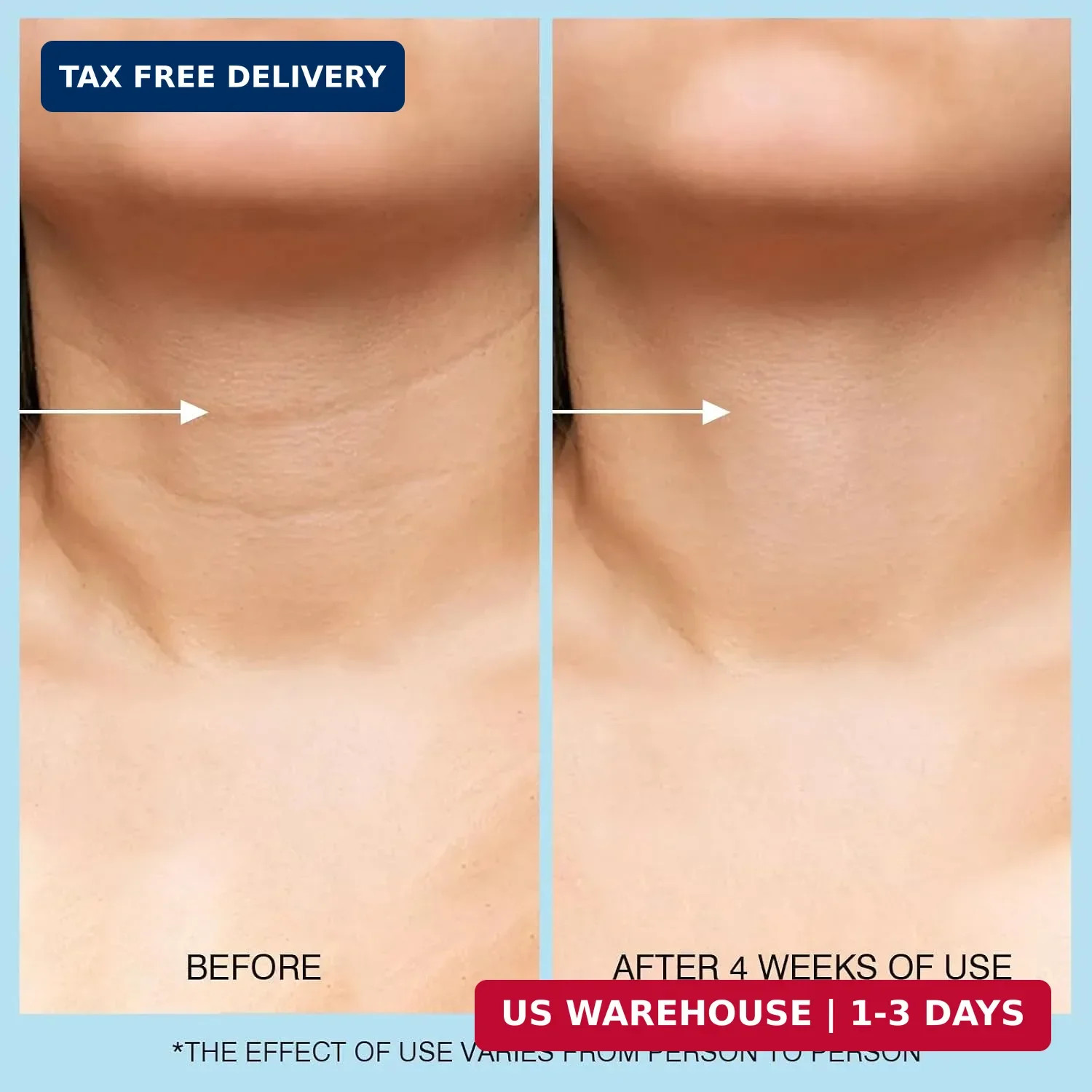 UJhay Retinol Neck Cream, Hyaluronic Acid and Caffeine Enriched Neck Firming Cre