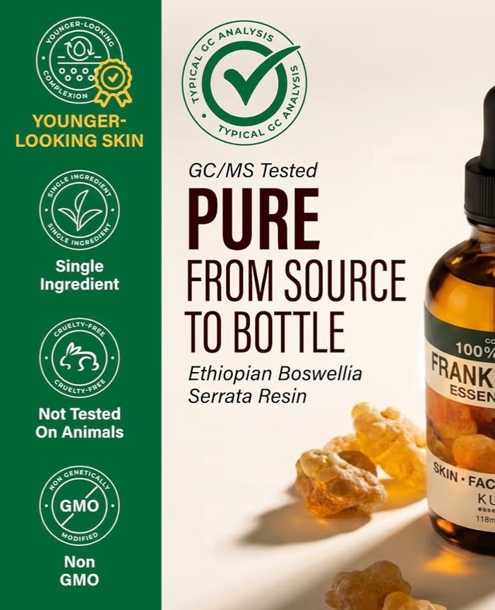 100% Pure Frankincense Oil – 4 Fl Oz Frankincense Essential Oil for Hair, Skin,