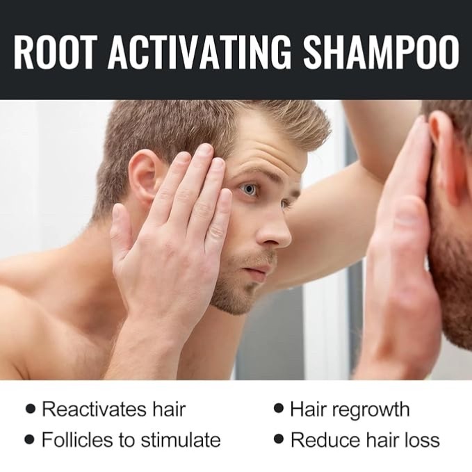 Root Activator Shampoo SPARTAN Hair Loss Shampoo Root Activator ( 100ml ) 2 pcs