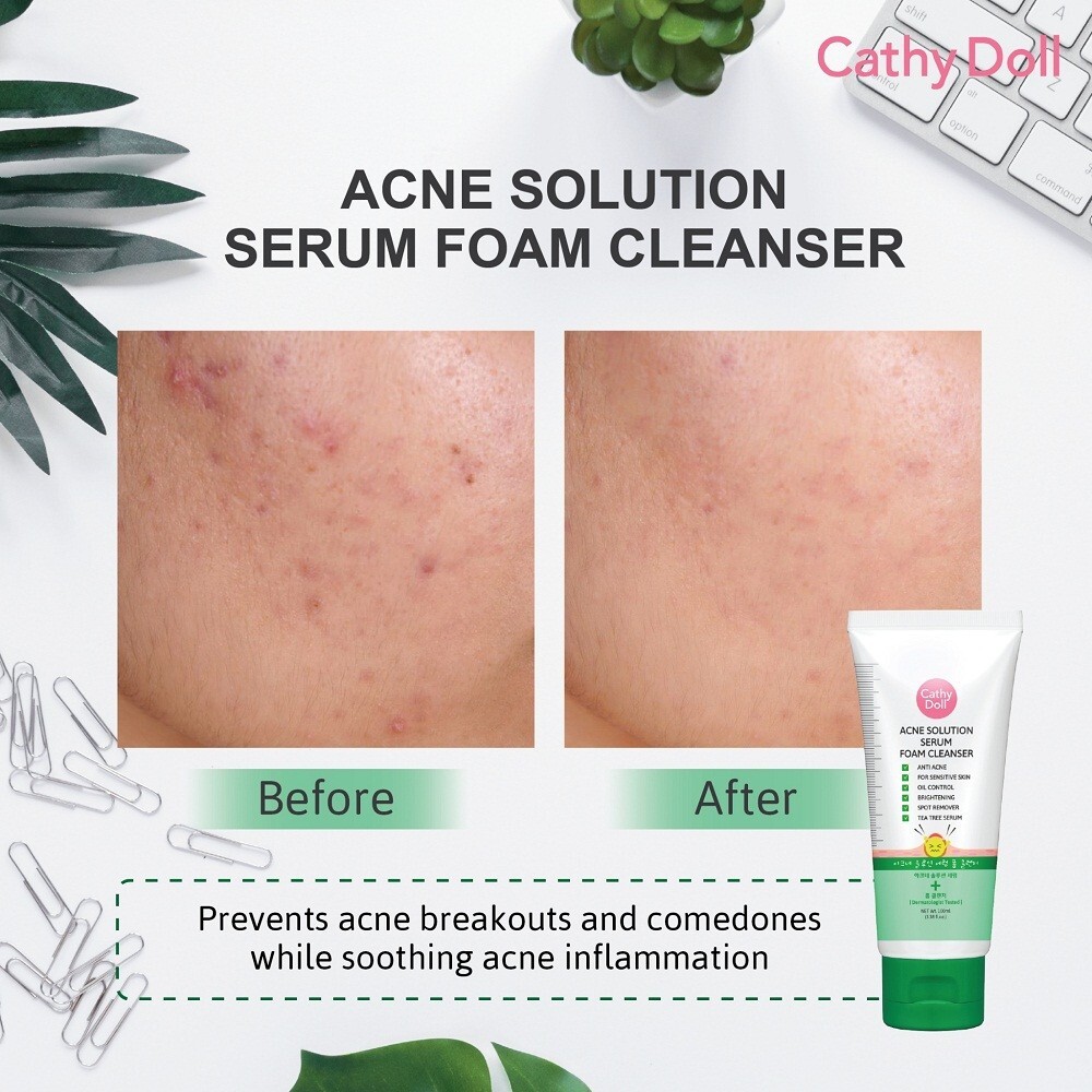 Cathy Doll Acne solution serum foam cleanser brightening 100ml