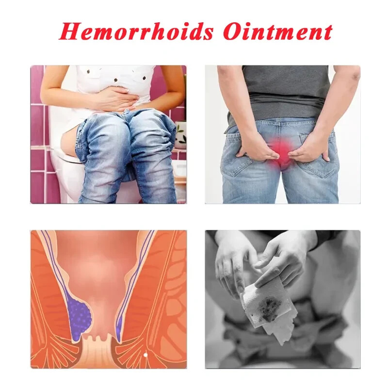Hemorrhoids Remove Ointment Herbal Cream Relief Piles Pain Reduce Itching SALE