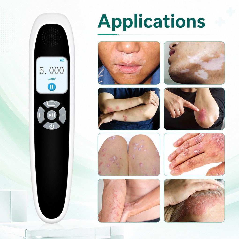 Compact 308nm UVB Light 6 Diodes 20mW/cm² for Skin Evenness and Healthy Glow